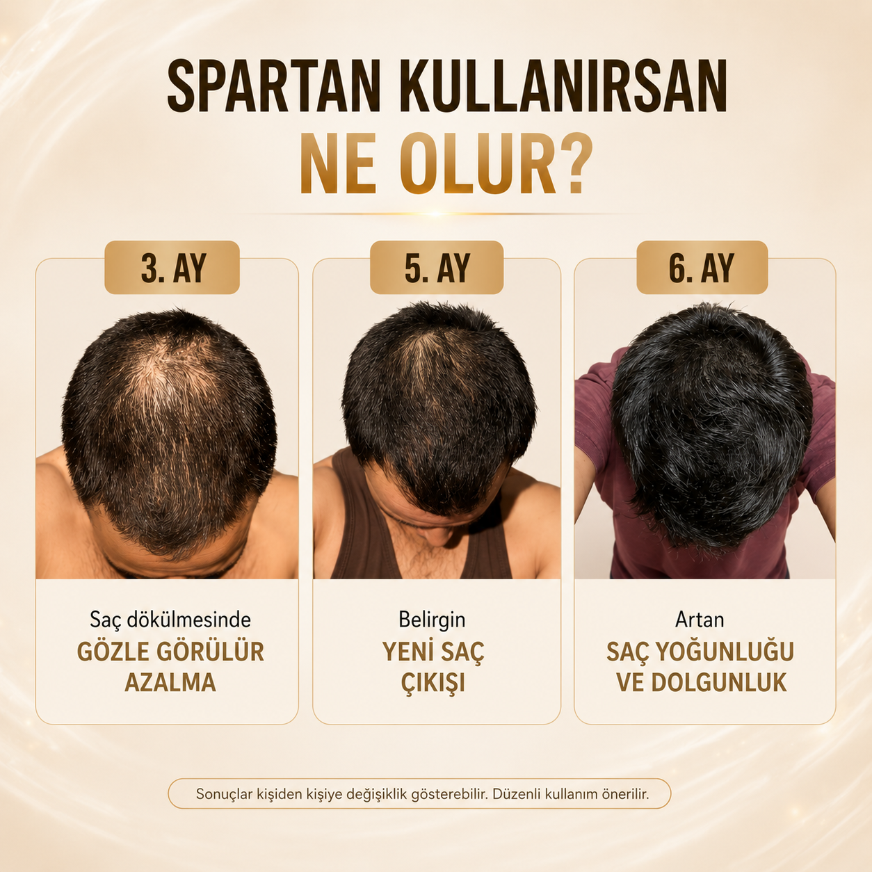 SPARTAN SAÇ ÇIKARAN ŞAMPUAN