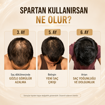 SPARTAN SAÇ ÇIKARAN ŞAMPUAN